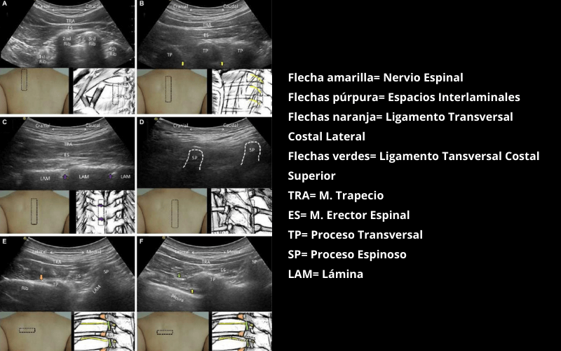 Nervios Espinales Dorsales (1).png